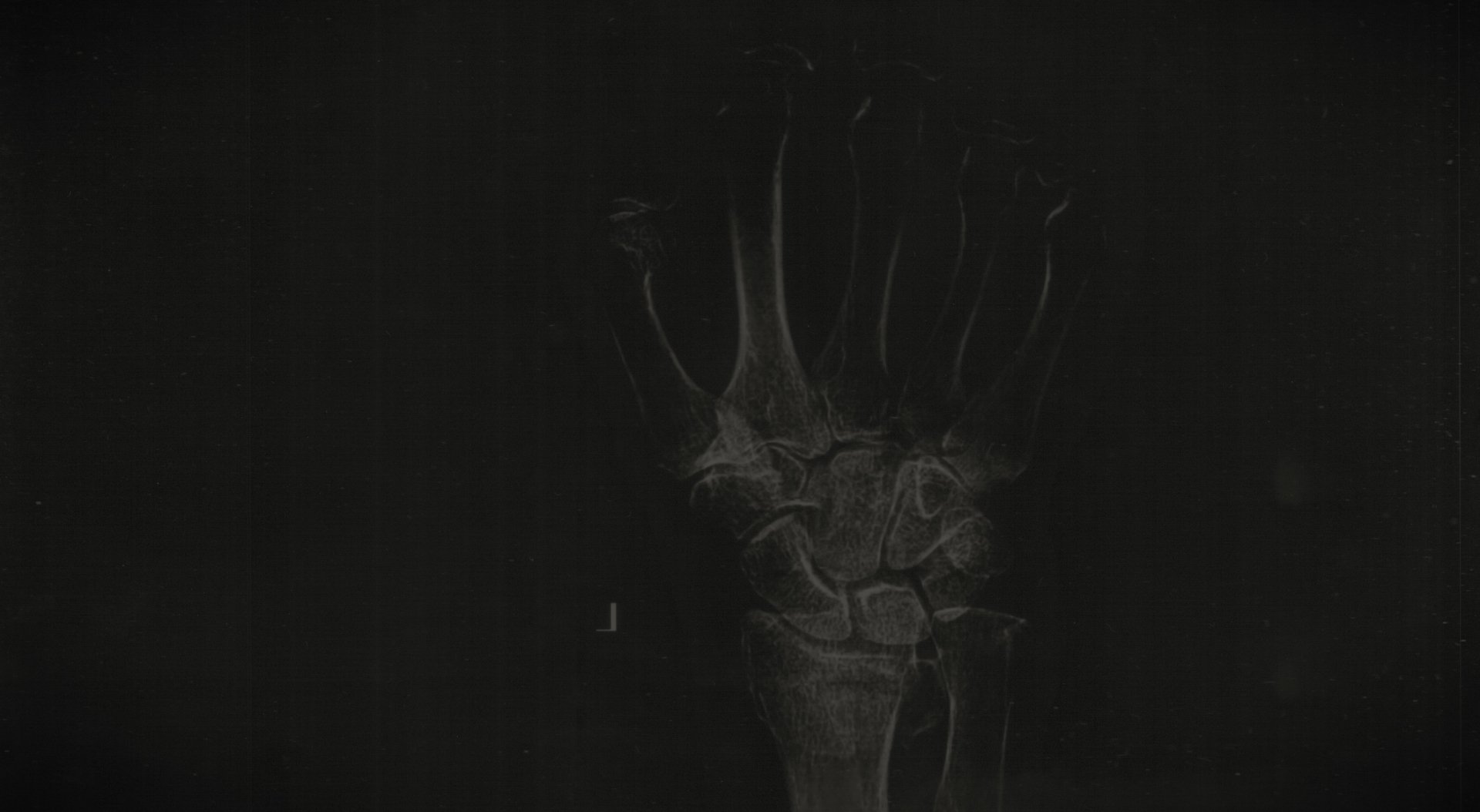 Xray by Hassaan