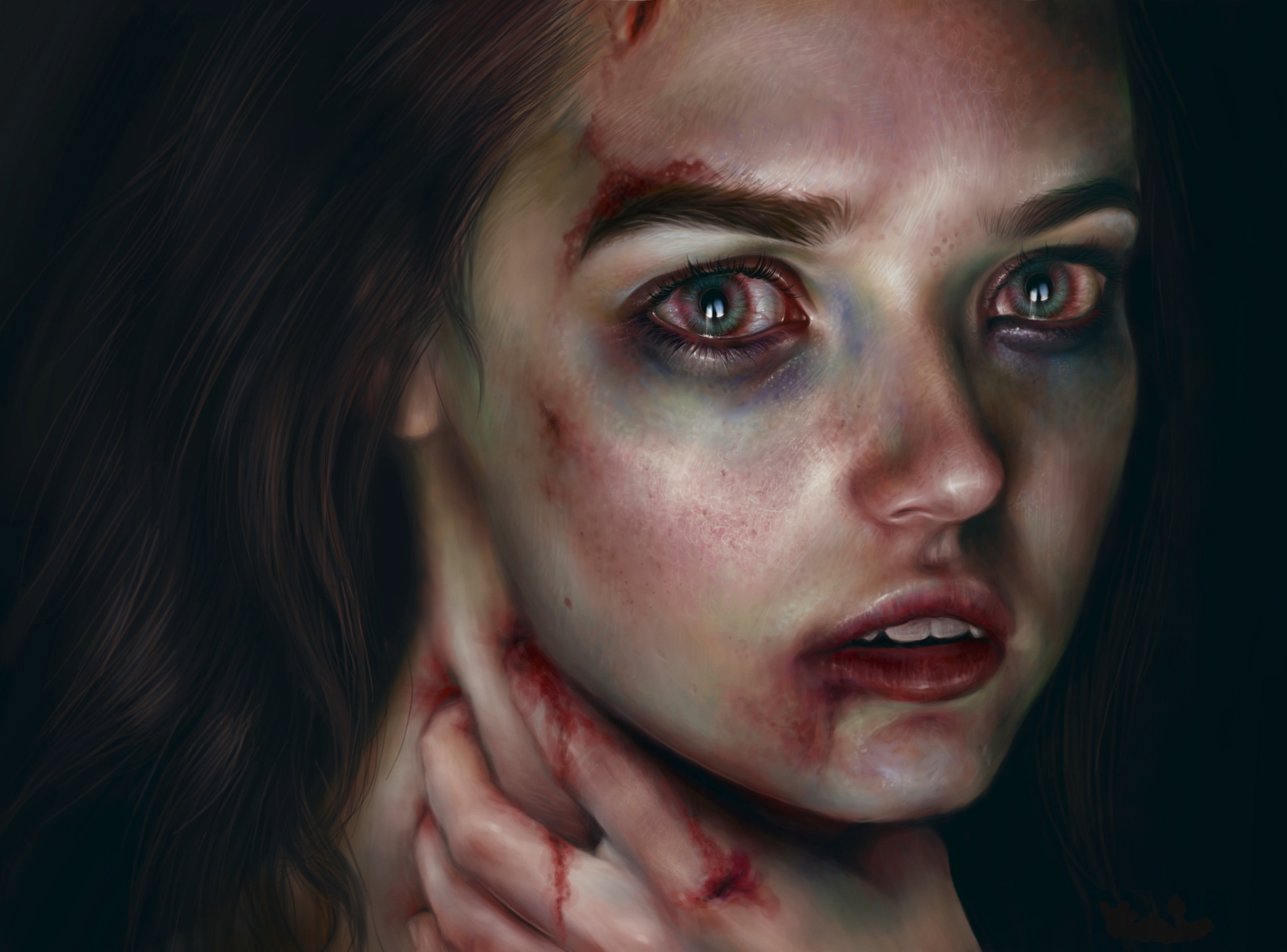 Injured Girl by Elena Sai